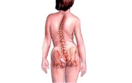 ragioni per lo sviluppo dell'osteocondrosi cervicale