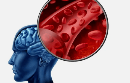 sintomi di osteocondrosi del rachide cervicale