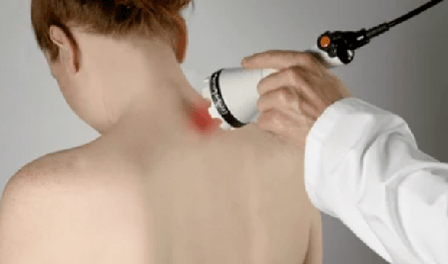 trattamento dell'osteocondrosi cervicale mediante metodi fisioterapici