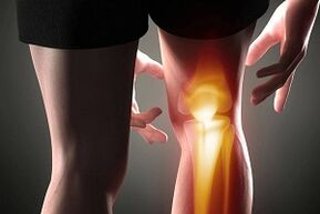 distruzione dell'articolazione del ginocchio a causa dell'artrosi