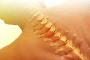 osteocondrosi come trattare